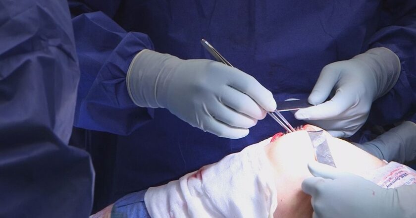 Burun kıkırdağıyla dizlere şifa | Euronews